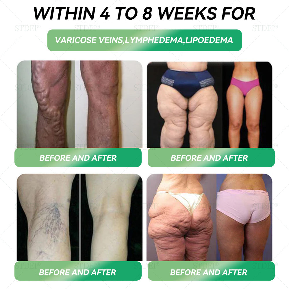 🔥 Only 10 boxes left! We're offering you an extra 30% off! HHVB® GLP-1 Oral Solution is doctor-tested and proven to be safe and effective — just 4 to 6 boxes are enough to help you manage your weight and blood sugar levels with long-lasting results!
